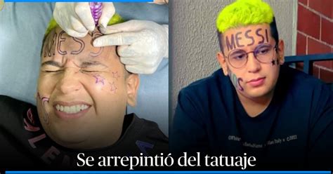 Influencer que se tatuó MESSI en la frente se echó pa atrás y