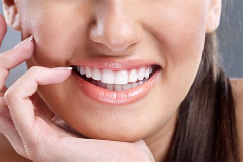 Qué son las carillas dentales y para qué sirven MVP Dental Móstoles