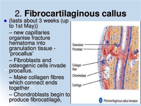 Fibrocartilage callus formation – Libracha