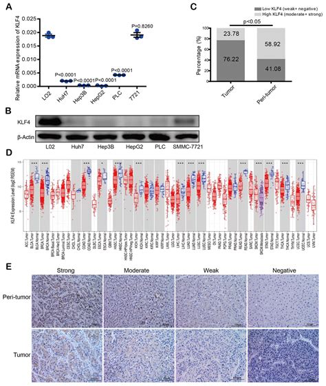 association  klf   tumor suppressor   prognosis