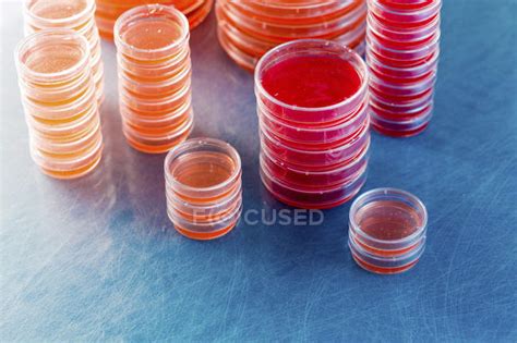 Stacked Agar Plates With Microbiological Cultures On Plain Background