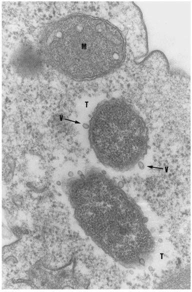 Transmission Electron Micrograph Of A Section A Polyphaga Infected Download Scientific Diagram