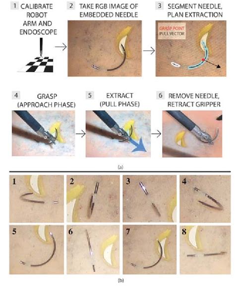 Figure 1 From Automated Extraction Of Surgical Needles From Tissue