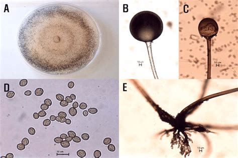 Rhizopus Stolonifer Under Microscope