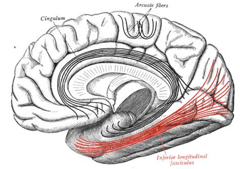 Fasciculus Longitudinalis Inferior Cerebri Ars Neurochirurgica