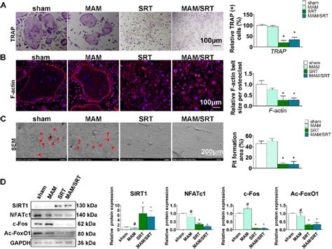 MAM SRT Suppressed The Osteoclastogenesis In Vitro A TRAP Staining