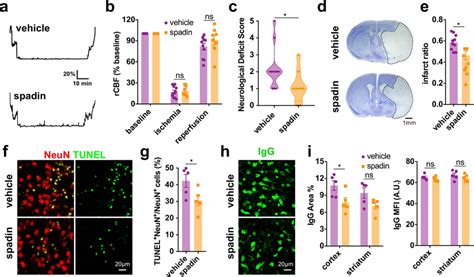 Pharmacological Inhibition Of Trek Has A Neuroprotective Function In