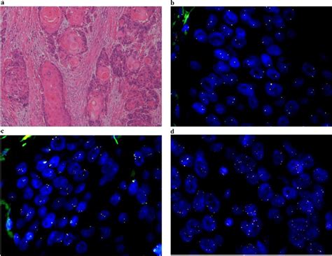 Representative Images Of H E Stained Magnification A And Fish