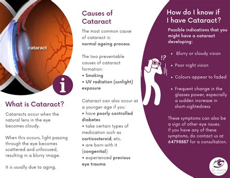 Customized Cataract Surgery Dr Alicia Eye Specialist