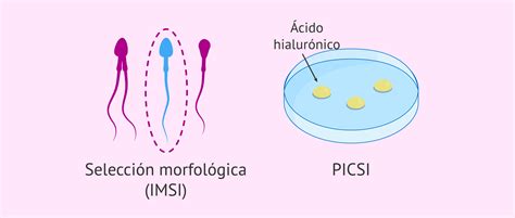 Imsi Y Picsi Para La Selecci N Esperm Tica