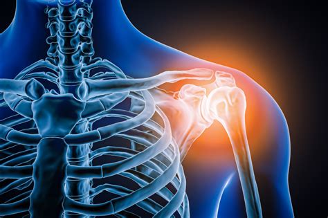 Preparing for Rotator Cuff Repair Surgery: What to Expect