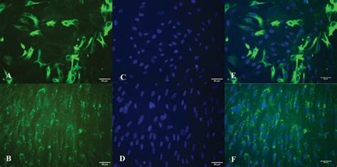 RPE cell characterization. Note the immune reactivity of the cultivated ...
