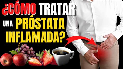 CÓMO TRATAR UNA PRÓSTATA INFLAMADA DE FORMA NATURAL YouTube