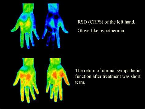 What Is Thermal Imaging Gaston Thermal Imaging Inc