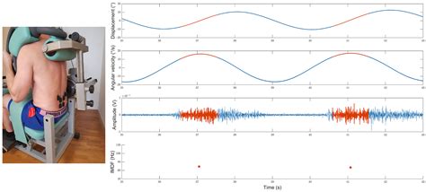 Surface Electromyography