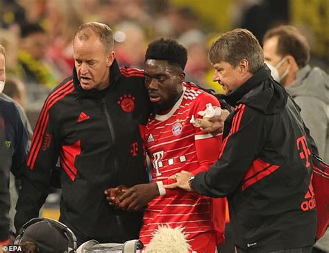 Alphonso Davies Diagnosed With Bruised Skull After Taking A Boot To