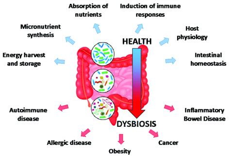 Schematic Representation Of The Transition From Healthy Microbiota To Download Scientific