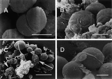 Scanning electron micrographs depicting various stages of the ... 