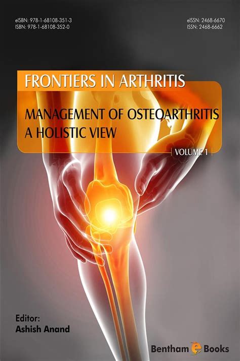 Management of Osteoarthritis - A holistic view eBook by Ashish Anand