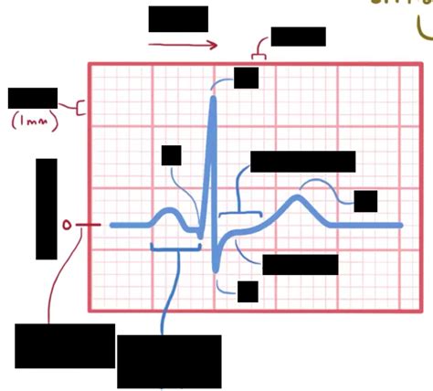 Ecg Graph Diagram Quizlet