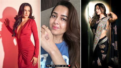 Tejasswi Prakash Sustains Burn Injury On The Set Of Celebrity Masterchef Tips To Prevent Burn