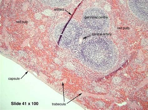 Histology Of Spleen