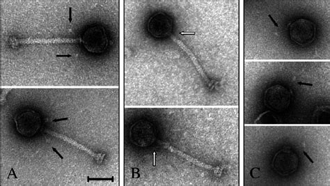 Transmission Electron Micrographs Of Tp Phages Negatively Stained