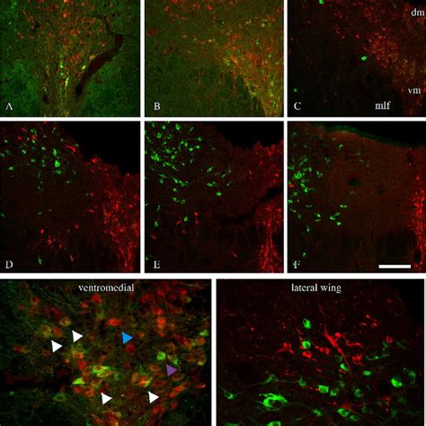 Representative Photomicrographs Of Nadph Diaphorase Staining In The