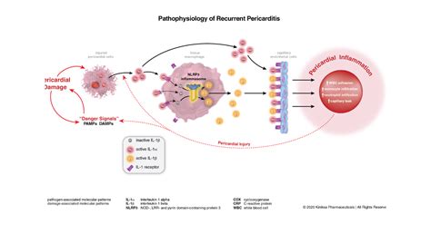 What Causes Recurrent Pericarditis? Underlying Factors