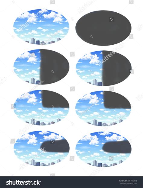 Pattern Visual Field Defect Following Stroke Stock Illustration ...