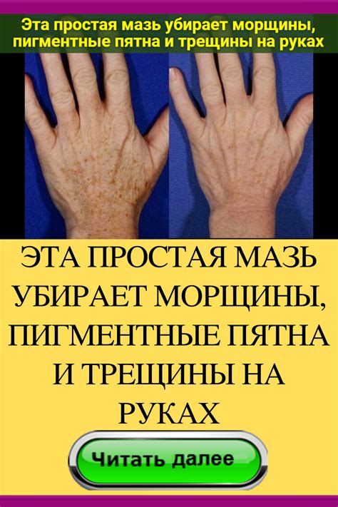 Эта простая мазь убирает морщины, пигментные пятна и трещины на руках