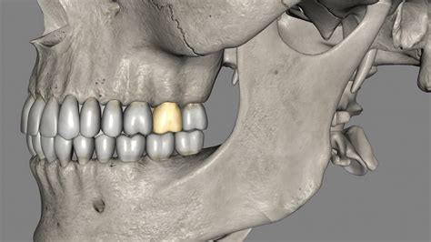 Todo Lo Que Necesitas Saber Sobre Los Implantes Dentales De Carga