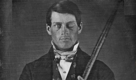 The Curious Case Of Phineas Gage Ep71 Hub History Boston History Podcast