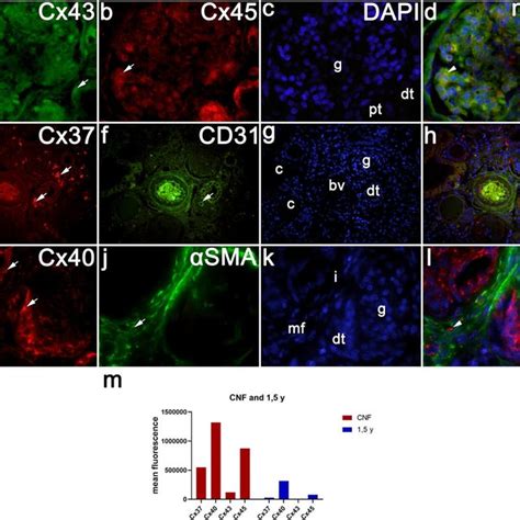 Co Expression Of Synaptopodin And Nephrin With Different Cx In