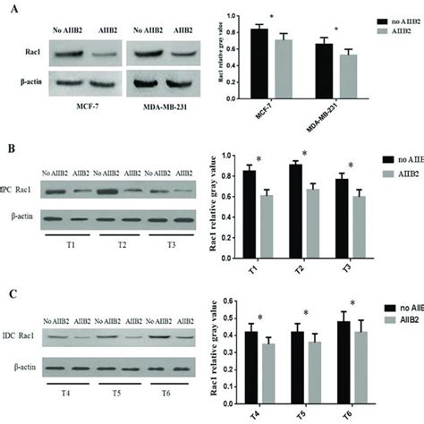 β1 integrin and Rac1 expression and polarity of breast cancer cell