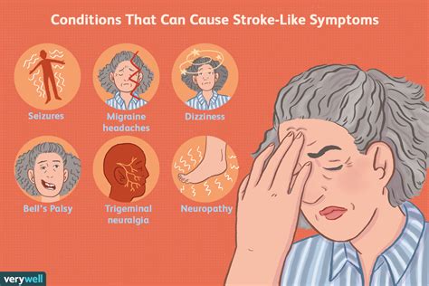 Signos Y S Ntomas De Un Accidente Cerebrovascular Medicina B Sica