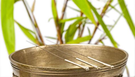 acupuncture-needles | Acupuncture & Chinese Herbal Medicine in Cairns