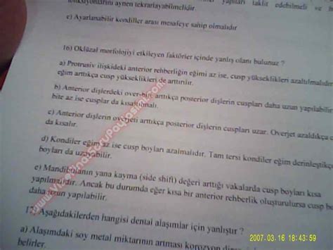 Protetik Diş Tedavisi Final Soruları Sayfa 13 Vize ve Final