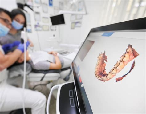 Orthodontie Et Technologie Simuler Son Futur Sourire Virtuellement