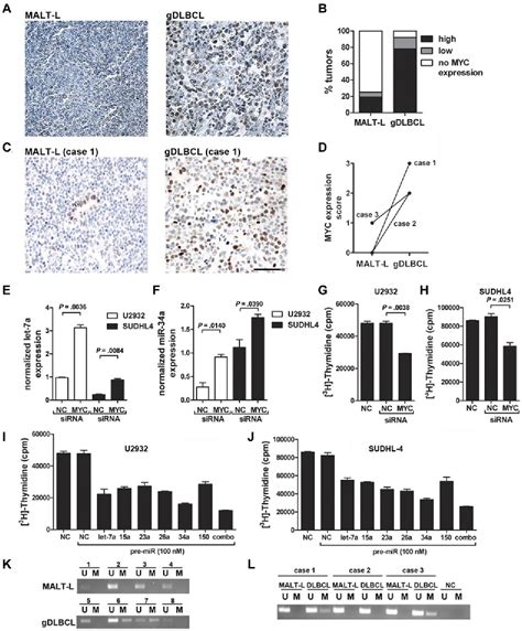 Figure 1 From Myc Mediated Repression Of Microrna 34a Promotes High Grade Transformation Of B