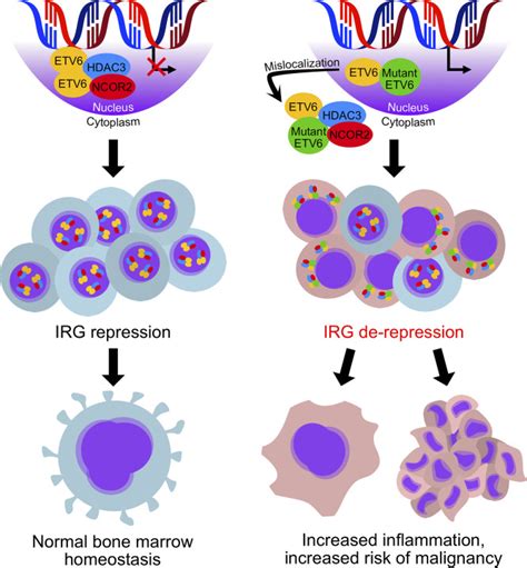 Etv Germline Mutations Cause Hdac Ncor Mislocalization And