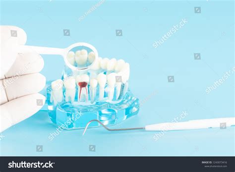 Check Nerve Molar Tooth Oral Health Stock Photo (Edit Now) 1243073416