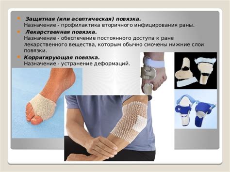 Виды хирургических повязок