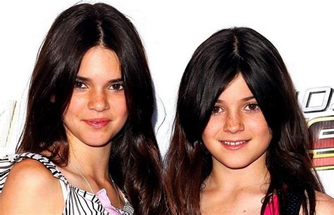 Kendall Jenner Before and After Plastic Surgery