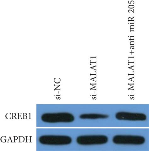 MALAT1 Exerts A Biological Role In MGCs By Regulating The MiR 205 CREB1