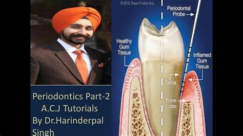 Periodontics Part 2 Youtube