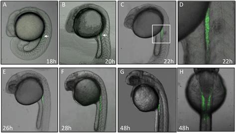 Dynamic Gfp Expression Pattern During Embryogenesis In Tg Gtshb Gfp