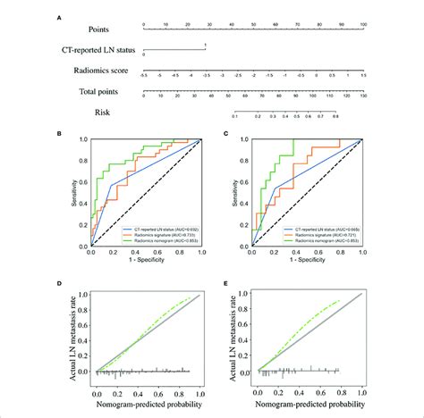 Radiomics Nomogram Developed With Receiver Operating Characteristic