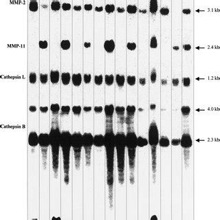 Northern Blot Analysis Of MMP 2 MMP 11 Cathepsin B And Cathepsin L