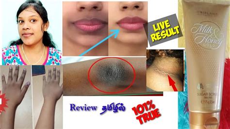 How To Remove Darkblack Patches Around Mouth Neck Oriflame Milk And Honey Gold Sugar Scrub